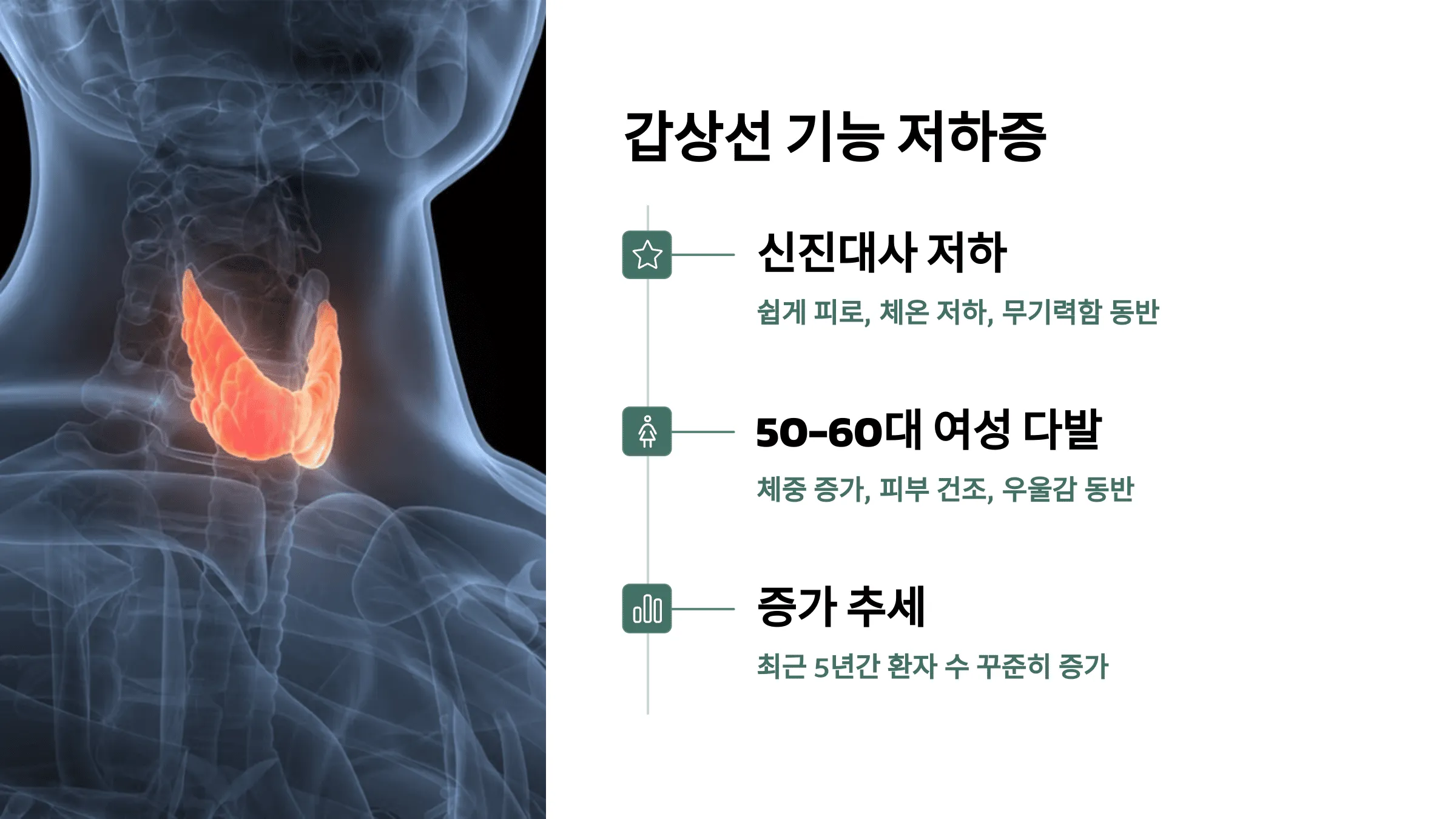 갑상선 기능 저하증 – 피로감의 대표적인 내분비 질환