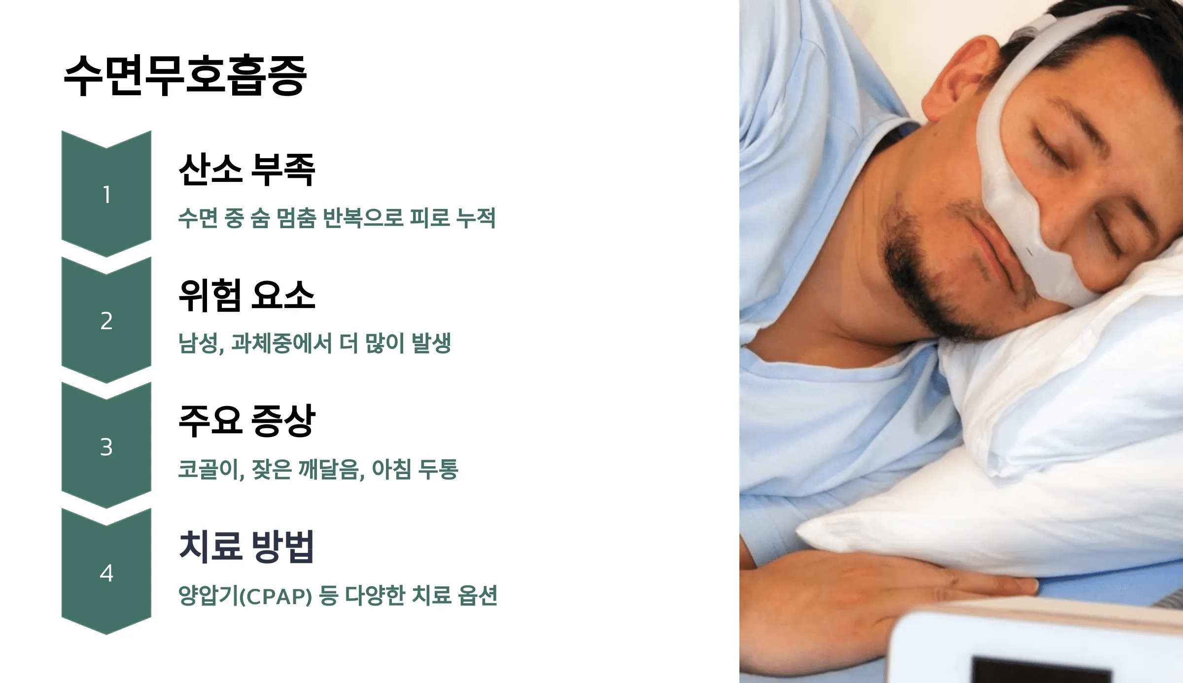 수면무호흡증 – 자는 동안 제대로 쉬지 못하는 상태